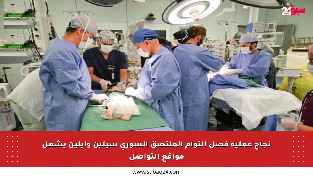 نجاح عملية فصل التوأم الملتصق السوري سيلين وإيلين يشعل مواقع التواصل
